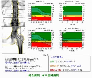 骨密度測定結果