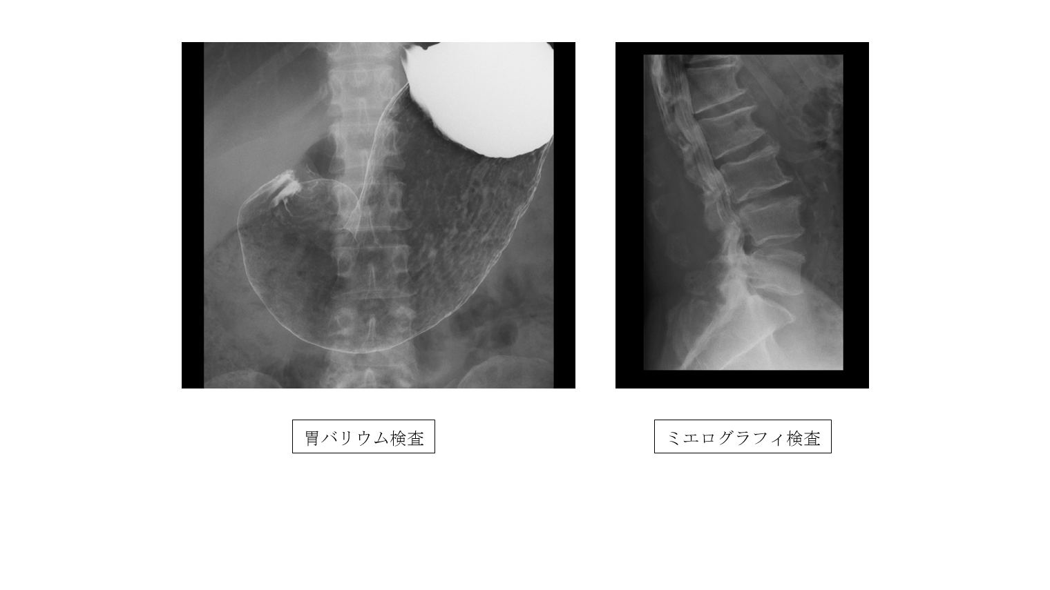 当院での検査例