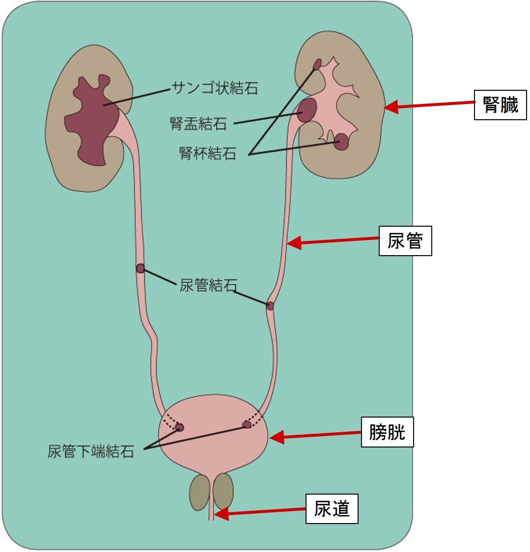 尿路図イラスト